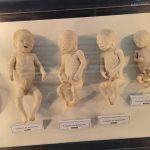 “Bodies” invita a reflexionar sobre la vida y cuidar la salud: Mónica Villarreal